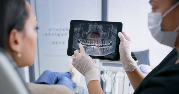 Licensed Tooth Extraction service in Tazewell County County, IL - Smile Center Dentistry